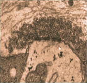 Synaptic vesicles clustered at a cell's membrane.