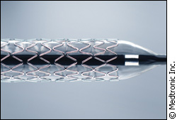Traditional "mesh" heart stent